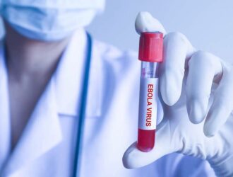 Sanepidqo‘m: Ebola virusi O‘zbekistonga xavf solmayapti